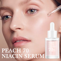 Niacinamide 10% Brightening Serum — Dark Spot Corrector