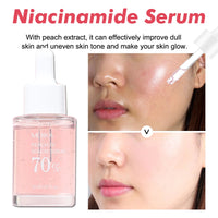 Niacinamide 10% Brightening Serum — Dark Spot Corrector
